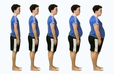 Morbid Obezite Nedir?